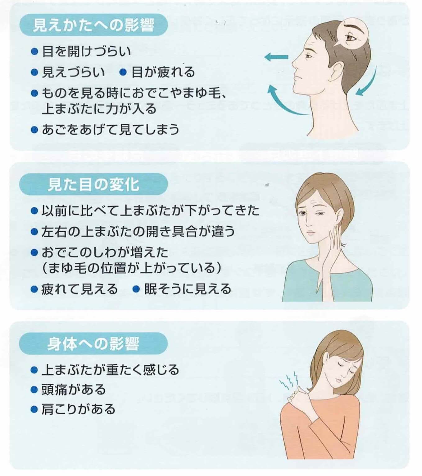 眼瞼下垂の症状のイメージ