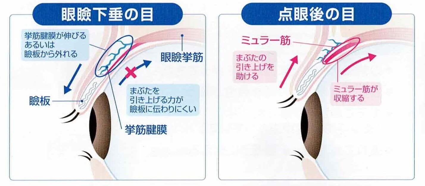 写真:薬の働きのイメージ