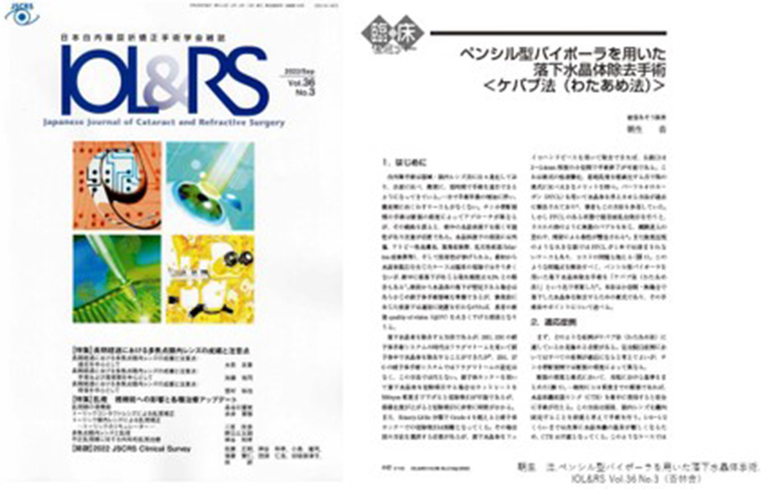 日本白内障屈折矯正学会雑誌IOL&RS Vol.36
