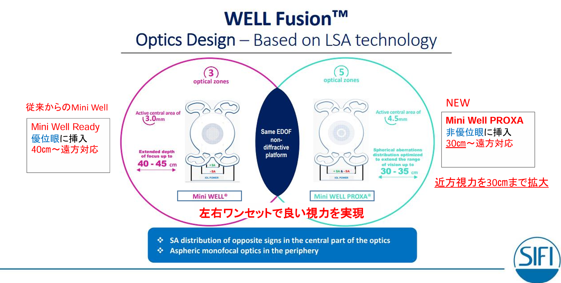 【裁断】多焦点眼内レンズ 眼内レンズについて | 白内障 | 安藤眼科医院